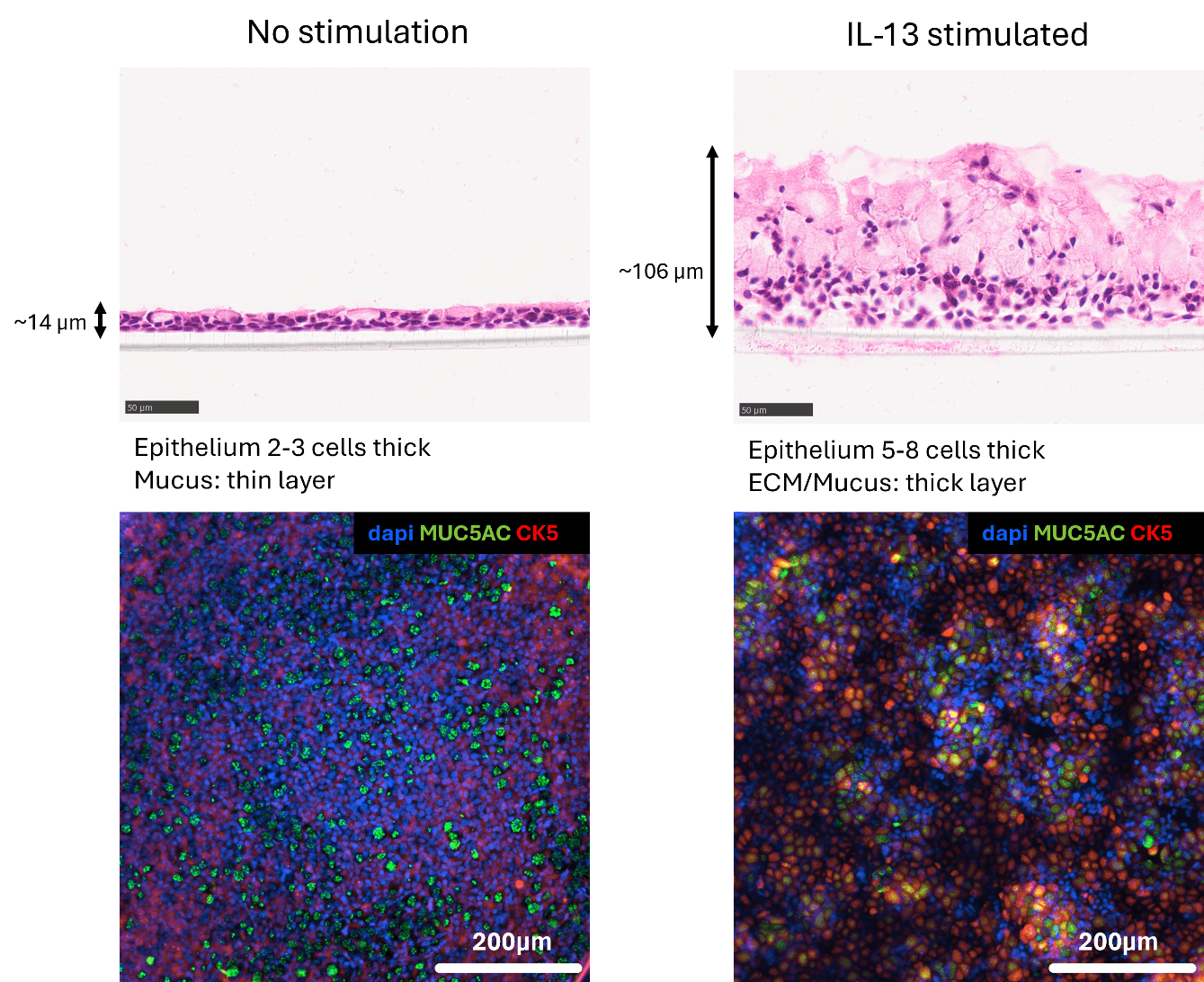 RoukenBio - Airway Epithelial Remodelling.png